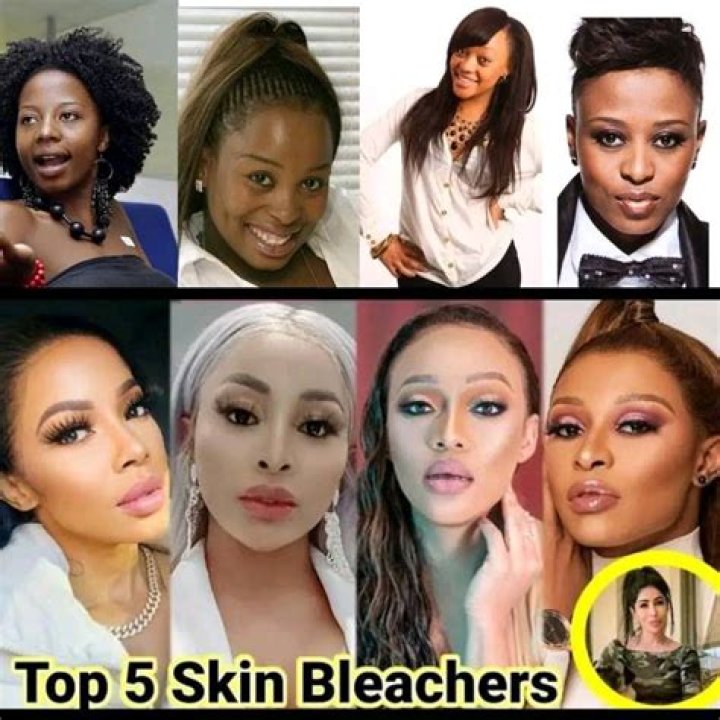 Celebrities Who Bleached Their Skin