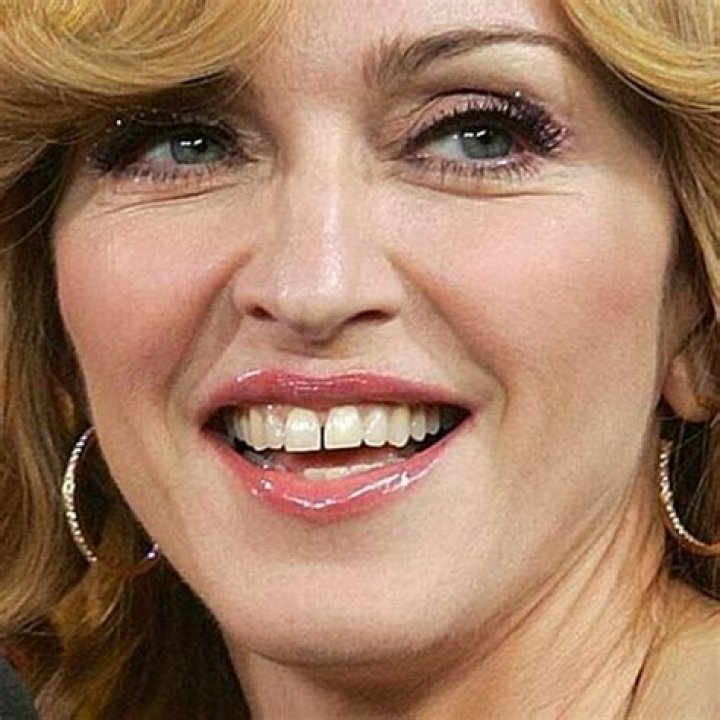Celebrities with Bad Teeth (13 pics)
