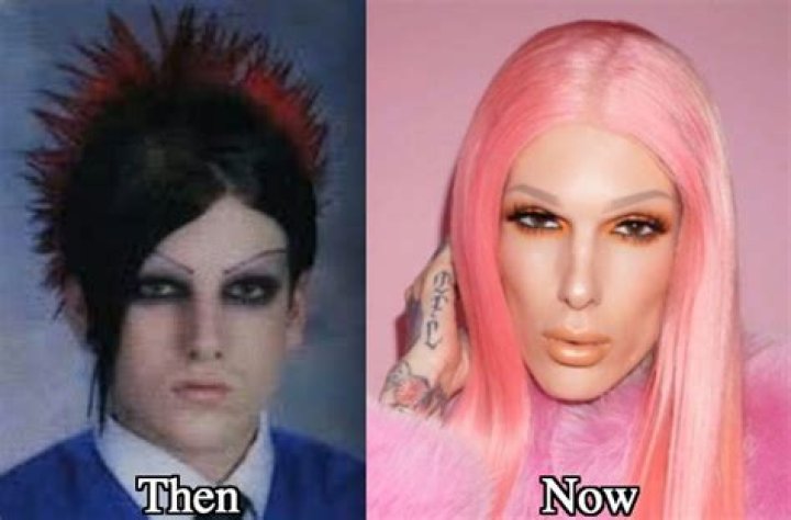 Jeffree Star plastic surgery Before & after pics Tuko.co.ke