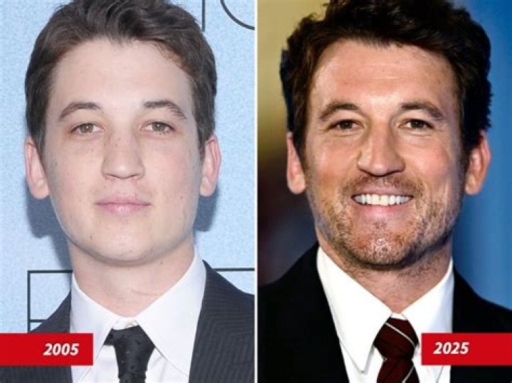 Miles Teller&rsquo;s Transformation Over the Years Photos Then and Now
