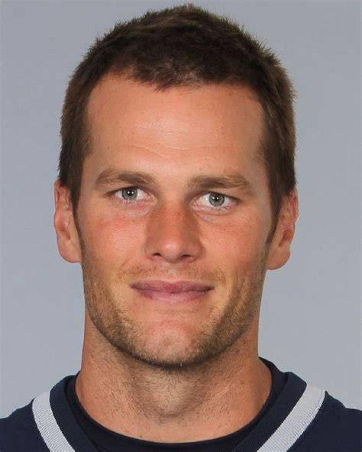 Tom Brady hair and face Open Hair Loss Topics Hair Restoration