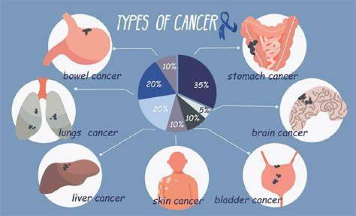 What type of cancer did Kelly Preston, John Travolta&rsquo;s wife, have