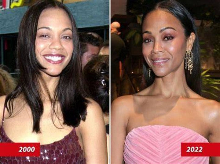 Zoe Saldana plastic surgery (29) Celebrity plastic surgery online